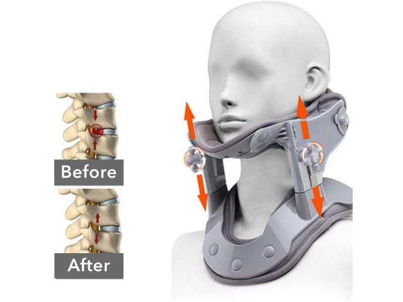 

Cervical brace cervical retractor, hot compress physiotherapy adjustable support corrective fixator