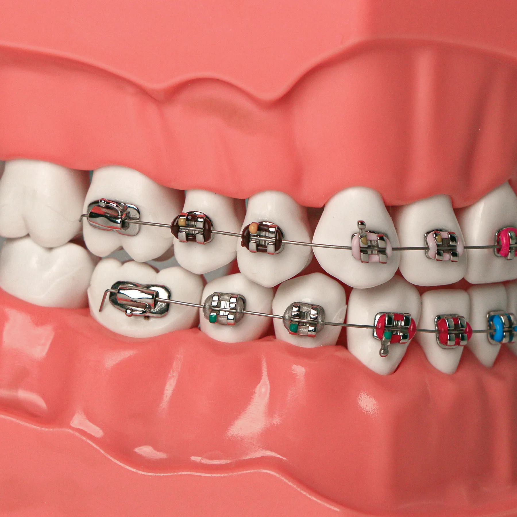 Modelo de dentes ortodônticos Typodont dentários 1:1, demonstração padrão, ensinar estudo com laços de ligadura de arco, suportes de metal, tubo bucal