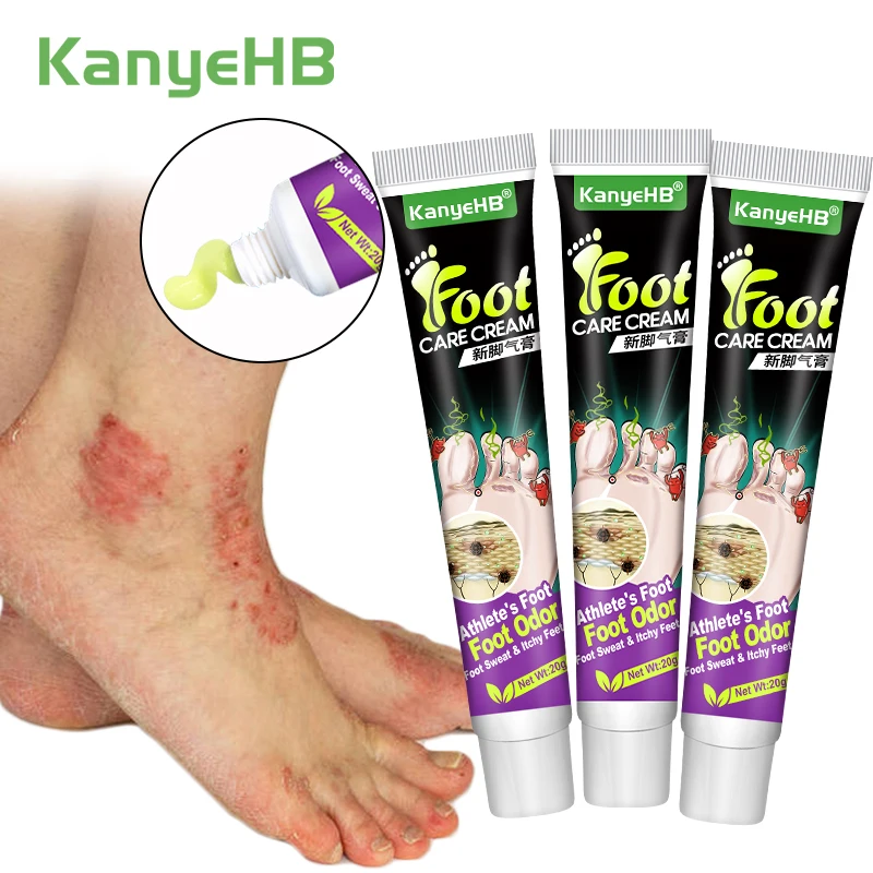 3Pcs Tinea Pedis Treatment Cream Anti-itch Inhibits Fungus Relief Foot Peeling Erosion Herb Athlete\'s Foot Skin Care Cream A1284