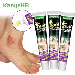 3Pcs Tinea Pedis Treatment Cream Anti-itch Inhibits Fungus Relief Foot Peeling Erosion Herb Athlete's Foot Skin Care Cream A1284