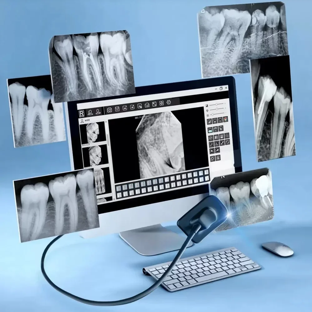 

Dental Sensor X-Ray Radiovisiograph High-Frequency With 13 Language Rx Digital Intraoral Digital System H D Image Dentistry Tool