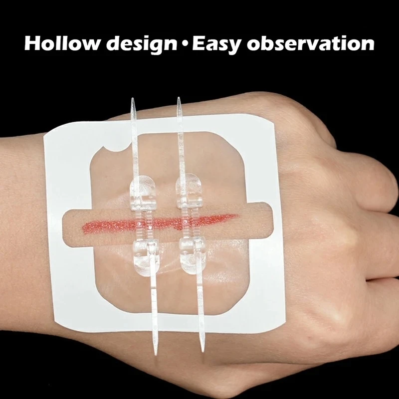 

Ленточные аппараты на молнии 2–10 лет, устройство для закрытия ран, не требует швов, быстрые и безболезненные ленточные аппараты, медицинская помощь на открытом воздухе