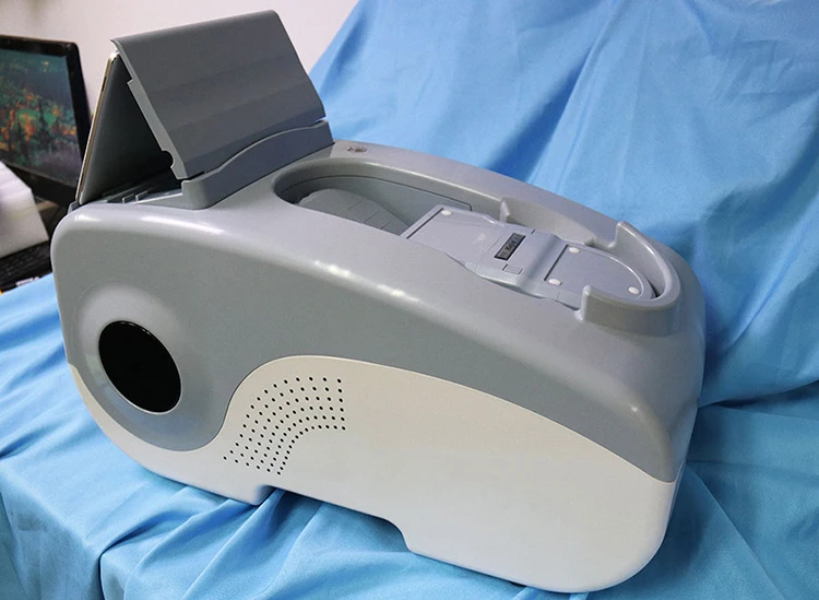 Ultrasound Bone Densitometer Bone Density Machine ultrasound scanner medic ultrasound