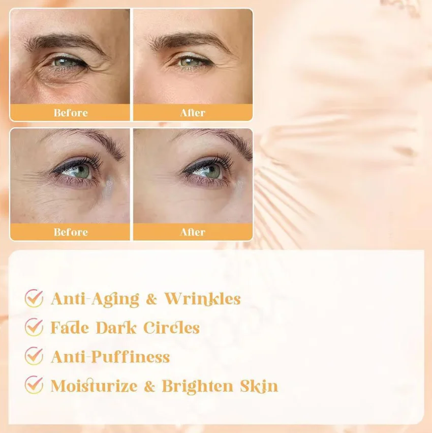 

Крем для удаления мешков под глазами, против морщин, против темных кругов, крем для глаз, восстановление поврежденной кожи, увлажняющие мешки под глазами, уход за кожей1