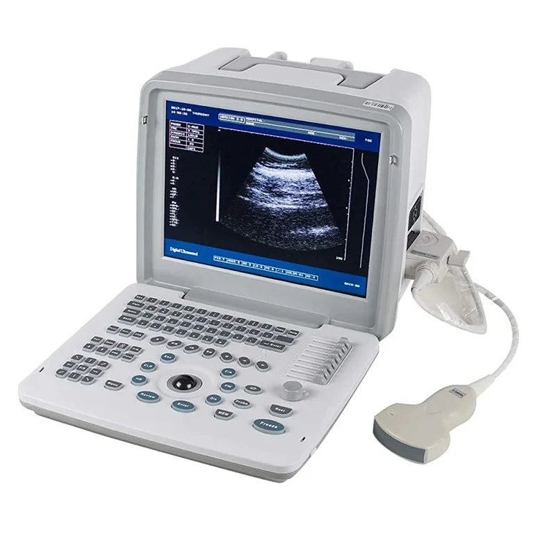 

CE Approved High Quality Black White Full Digital LED Portable Ultrasound Scanner Machine Used For Hospital