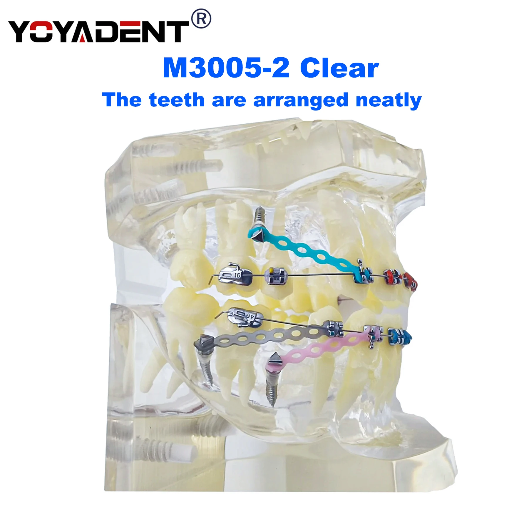 Dental Teeth Model Orthodontic Teeth Model Metal Arch Wires Ties/ Ceramic Brackets Orthodontic Correction Teaching