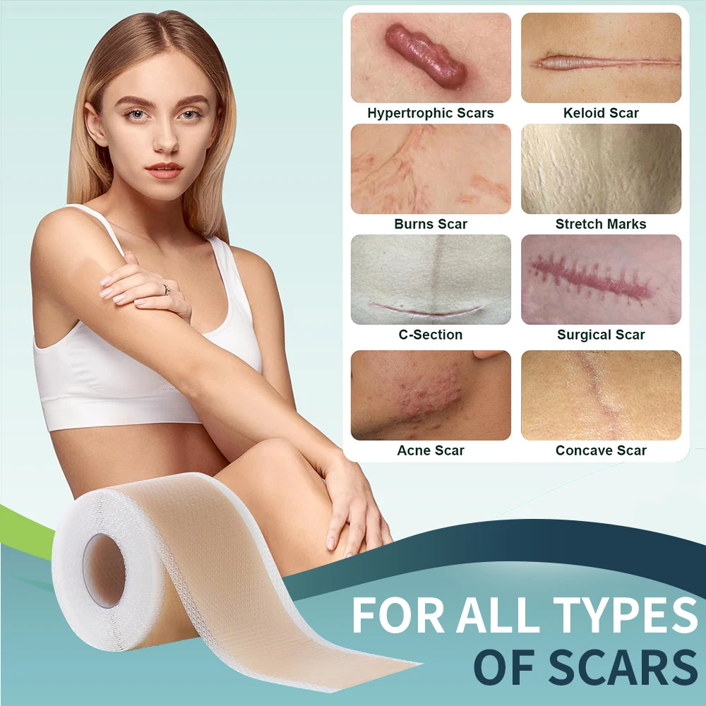 1.5/3M silikonowe plastry na blizny usuwanie niewidoczna podkładka korektorowa żelowa wodoodporna taśma leczenie do operacji cesarskiego oparzenia keloidowe podnoszenie brzucha