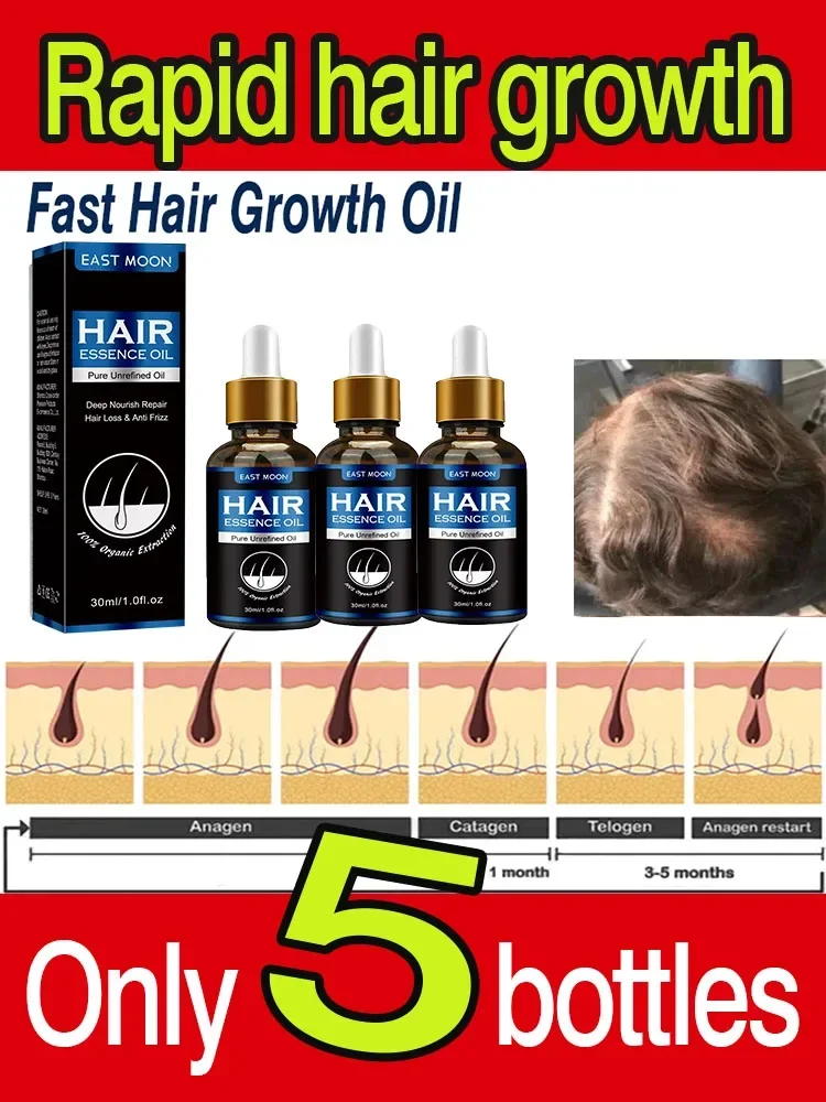 

Highly effective anti-hair loss Nourishing Essential Oil Intensive repair of damaged hair Moisturizing Smooth oil Natural