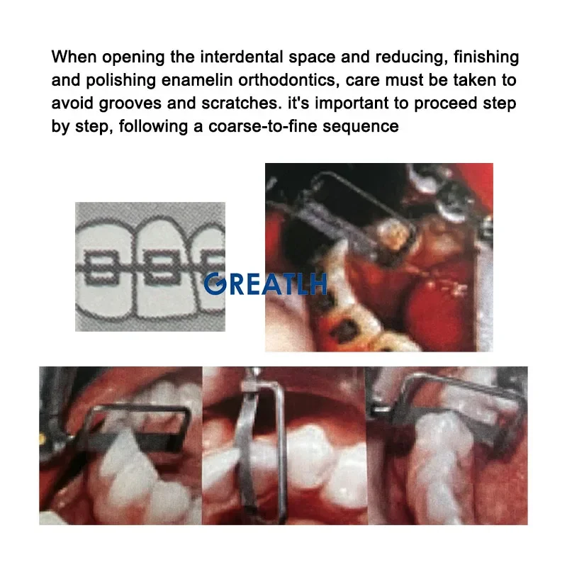 GREATLH Orthodontic Interproximal Enamel Reduction IPR Double-Sided Saw Diamond Saw Bow Dental Instrument