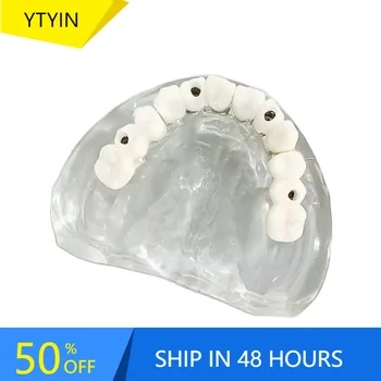 

YTYIN All On 4 Speedy Bridge Restoration Teeth Demonstration MaxillaryRepair Model