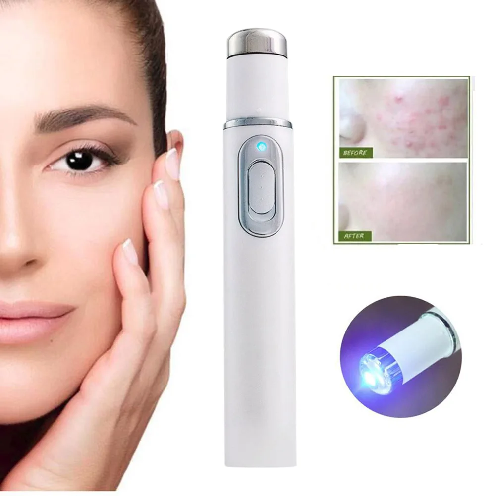 Blauwlichttherapie Acne Pen Verwarmde oogmassager Oogschoonheidsapparaat voor donkere kringen Wallen Wallen onder de ogen