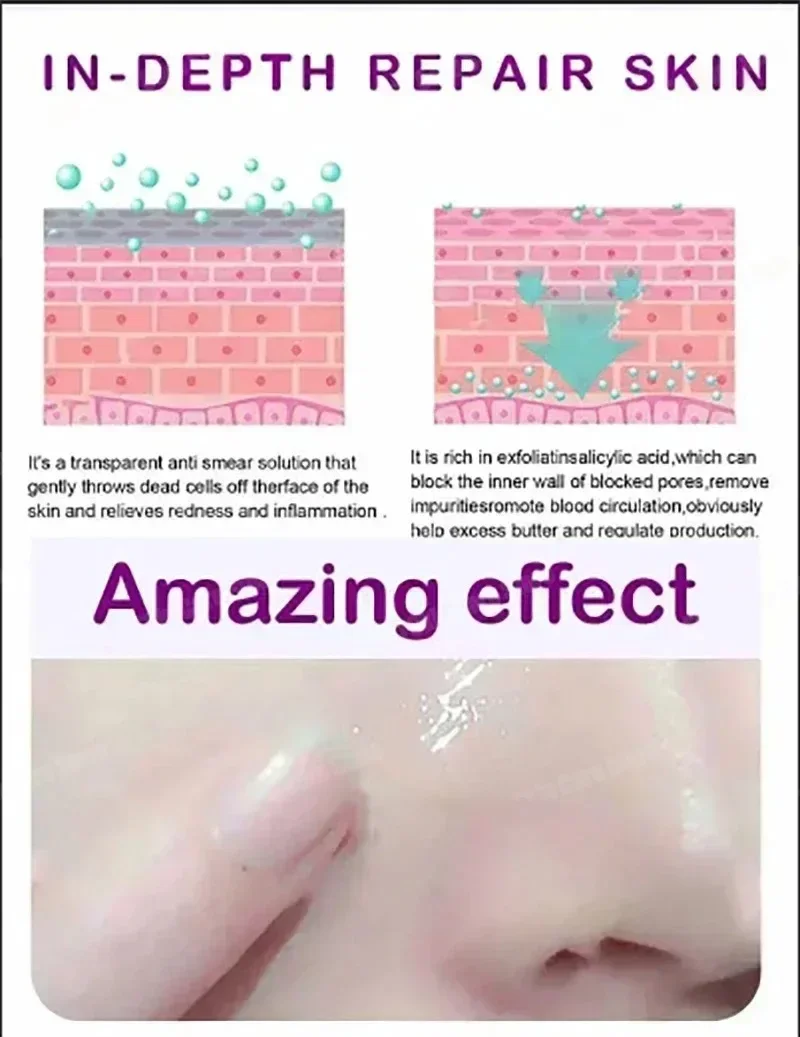 

Pore Shrinking Serum Moisturizing Facial Essence for Relieving Dryness Oil Long-lasting Calming for Sensitive Skin Care