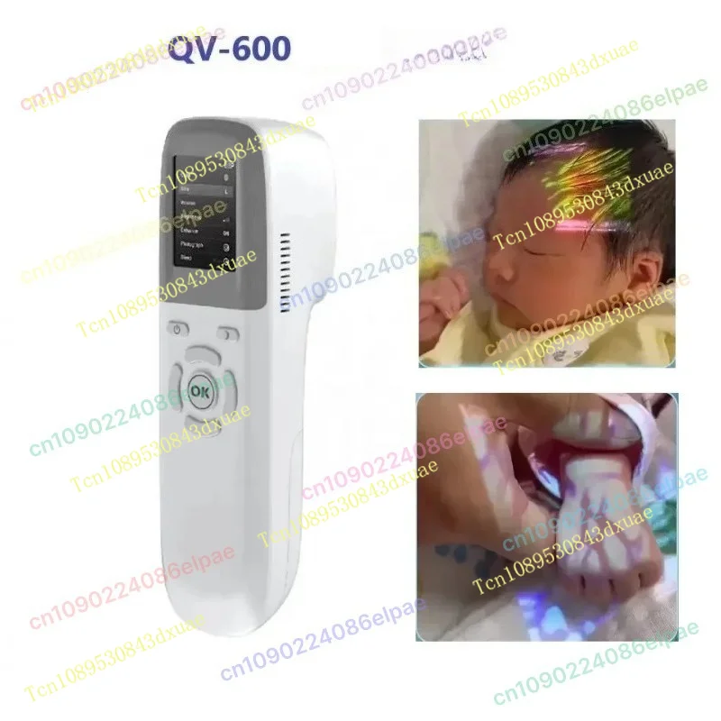 IN STOCK 2025 Vein Localization Device Suitable for QV-500/QV-600 Vascular Vein Localization/vein Detector/vein Scanner.