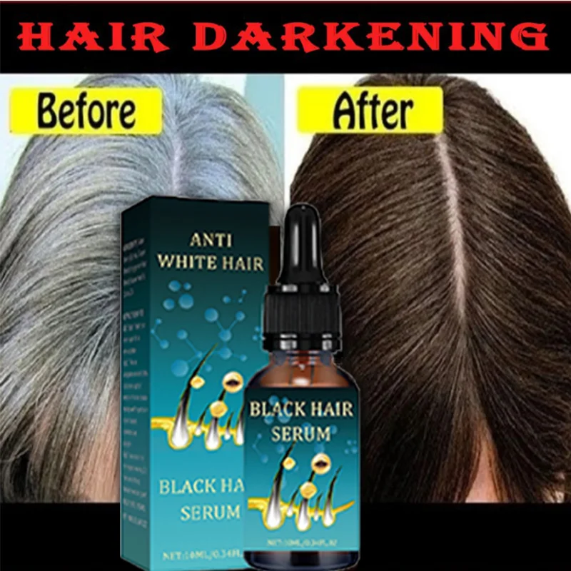 Healthy White To Black hair Anti-grey hair essence Serum treatment restore quickly turns white ahair into black naturalcolor