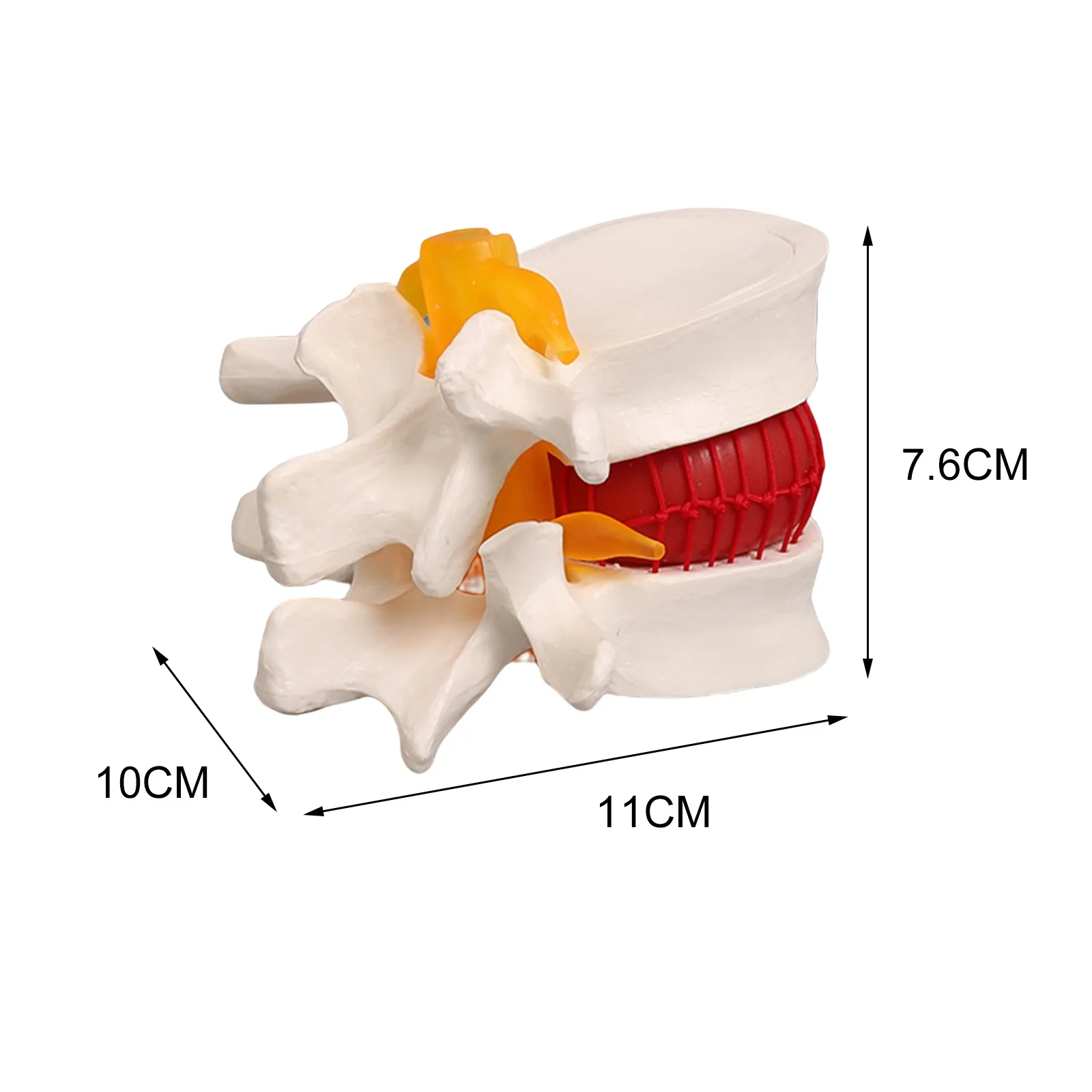 Medical Props Model Free Postage Anatomical Spine L umbar Disc Herniation An atomy Medical for School Teaching Tool