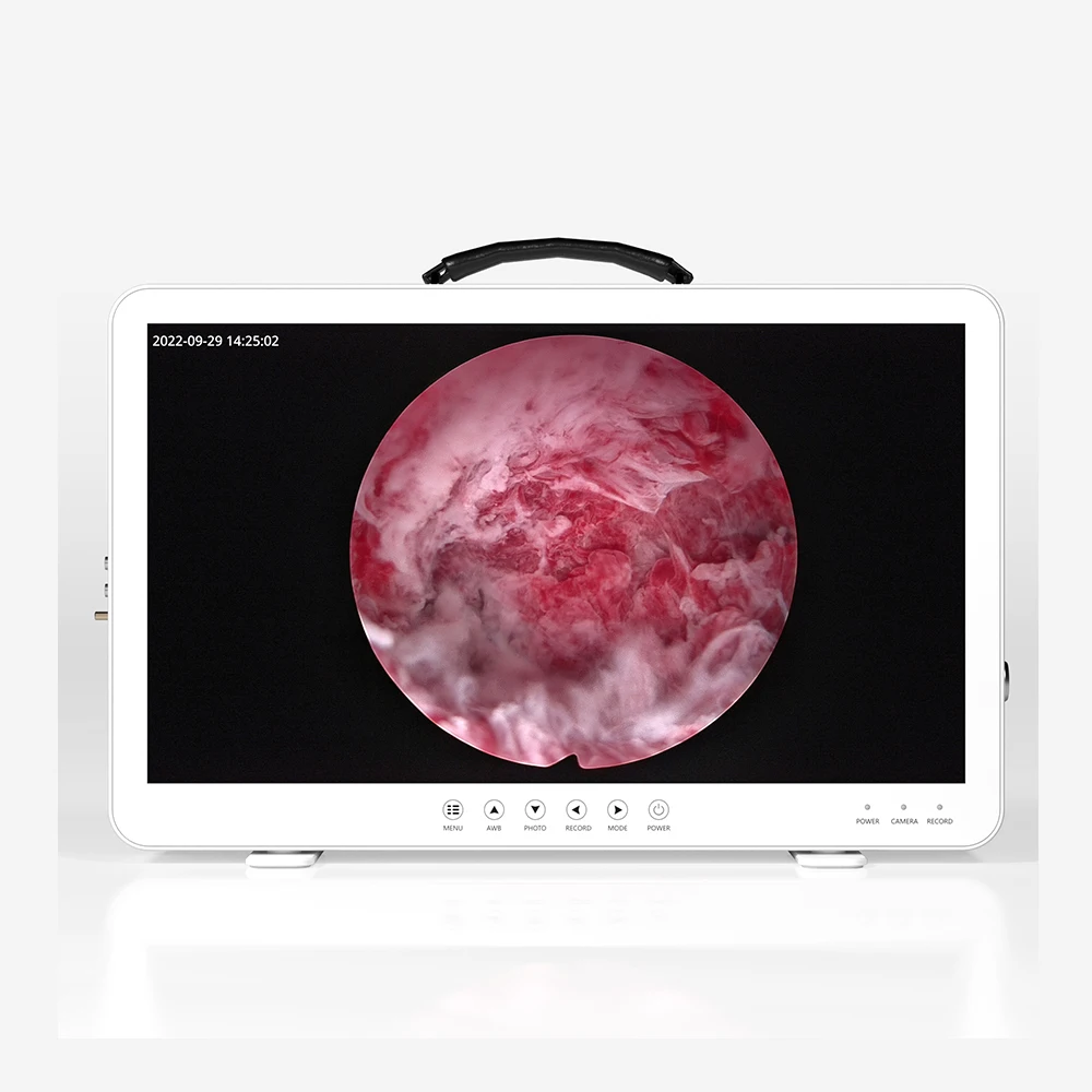 Camjoy 27 Inch Portable 4 in 1 Medical Diagnostic Endoscope  with Integrated Video System