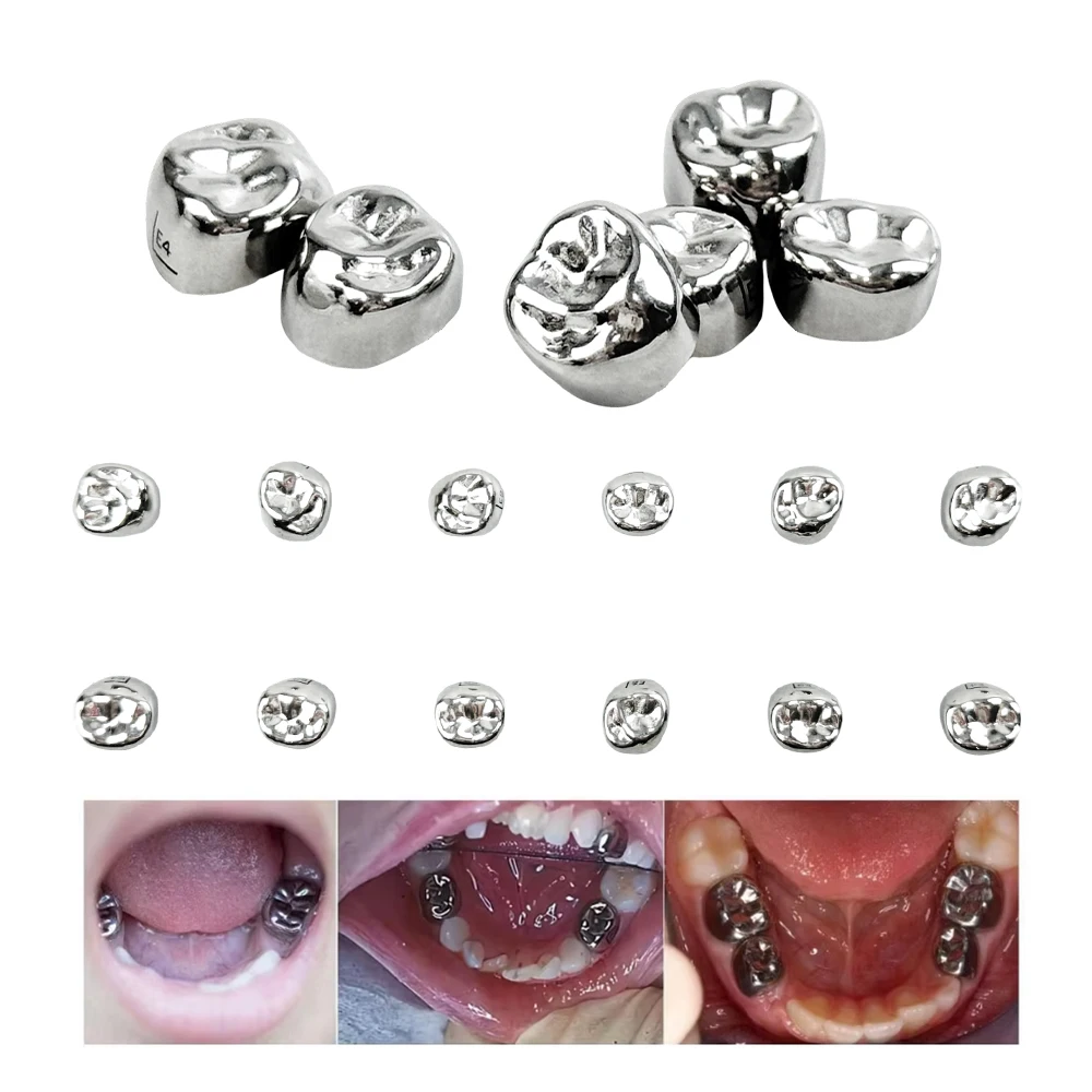 

12Pcs/Box Kids Crown Dental Preformed Metal Crowns Kids Primary Molar Teeth Stainless Steel Temporary Crowns Dentist Materials