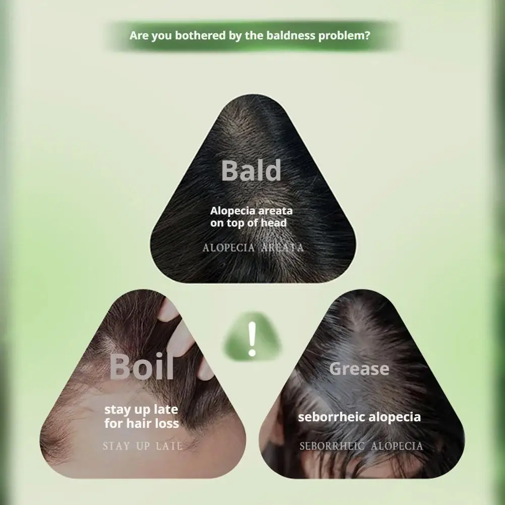 قالب شامبو عشبة أوسما الطبيعي بوليغونوم متعدد الأزهار لنمو الشعر، سماكة سواد وتغذي فروة الرأس ومكافحة تساقط الشعر