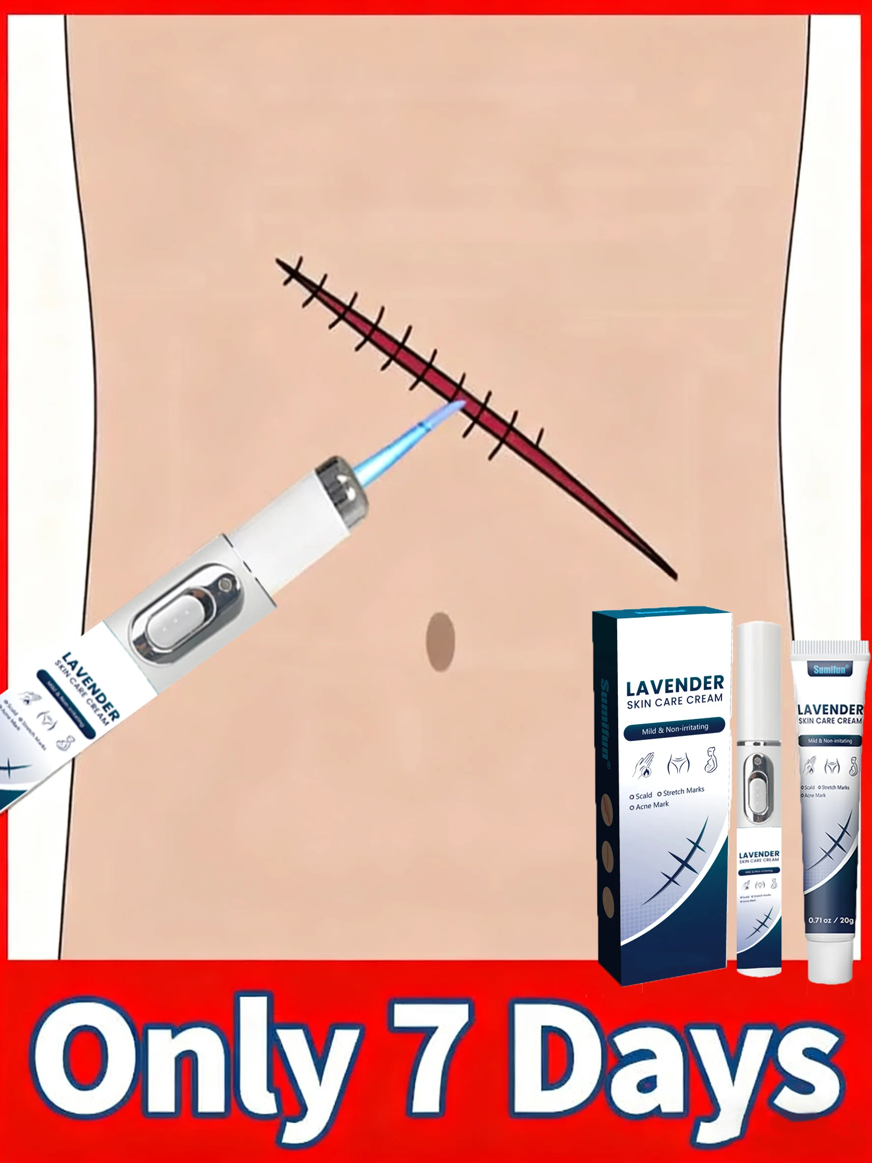 

Vanisher Stretch Mark для беременных: технология лазерной ручки с самым высоким рейтингом