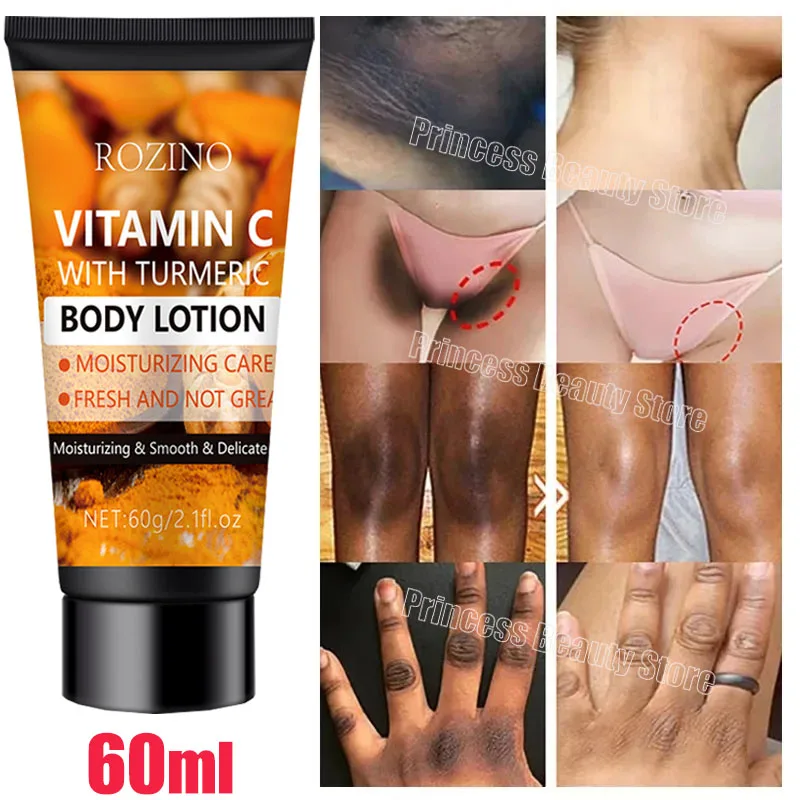 Body Whitening Cream Chicken Skin Removal Lotion Armpit Underarm Knees Bleaching Moisturizer Body Brighten White Care Products