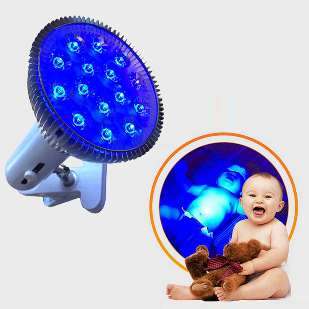 

Neonatal Physical Jaundice Physiologic Pathological Treatment Phototherapy LED E27 Blue Light Lamp