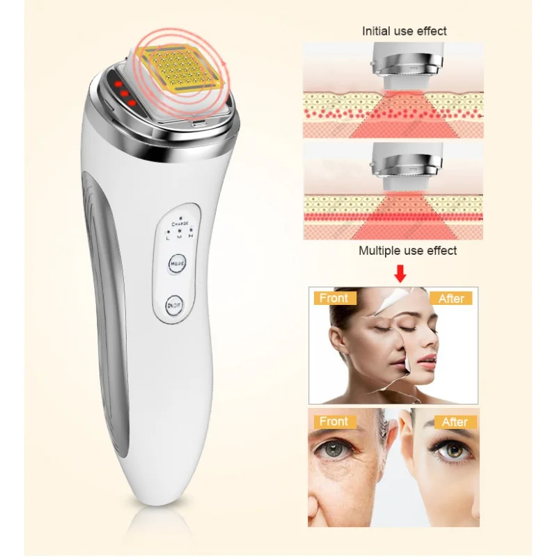 Mini At-Home Spa Device Rechargeable Skin Tightening Face Lifting Fractional Radio Frequency RF Beauty Apparatus Professional