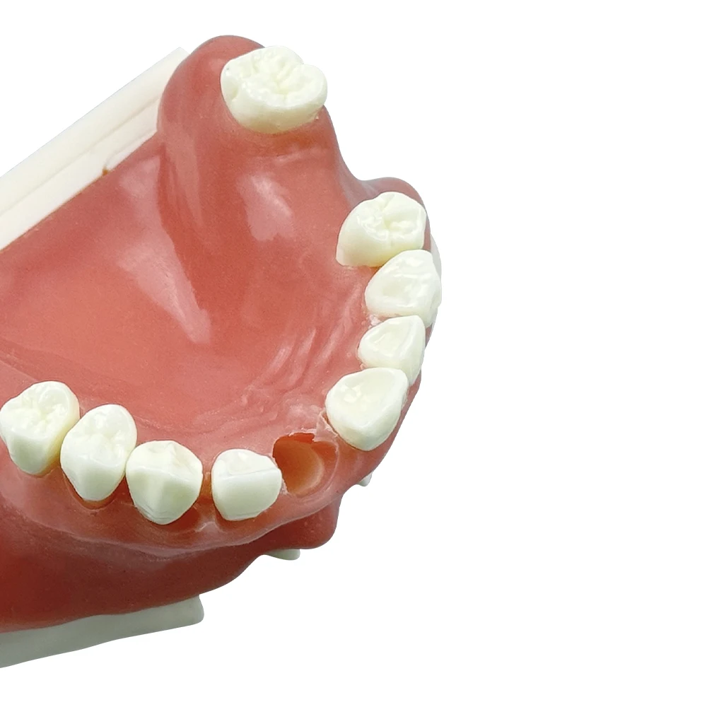 

Dental Maxillary Sinus Implant Practice Model Dentistry Teeth Training Model For Studying Teaching Demo Dentist Examination Tool