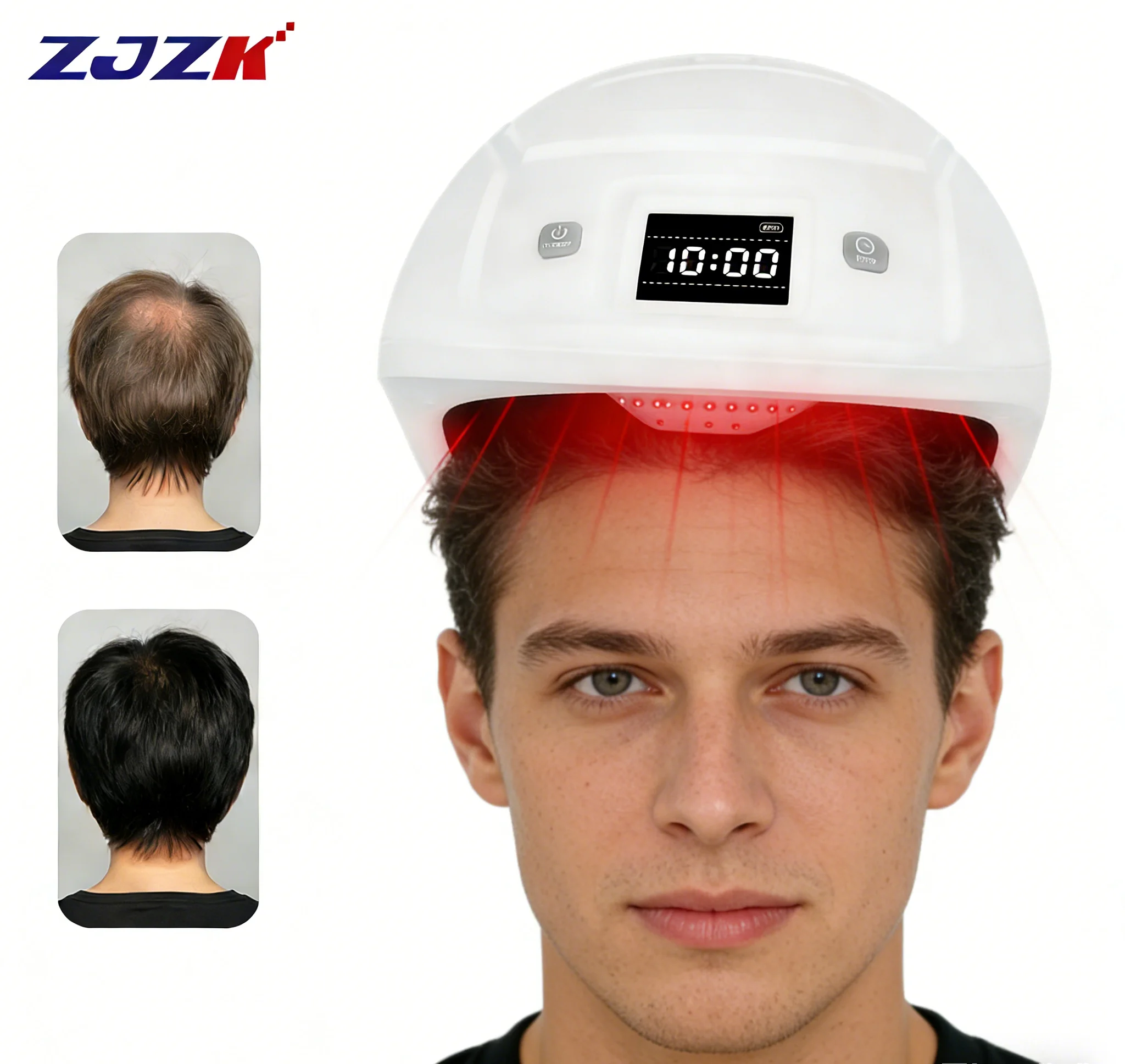 

2026Top Quality 650nm LLLT Laser Helmet for Hair Fall Control Receding Hairline Diffuse Hair Loss and Hormonal Hair Loss