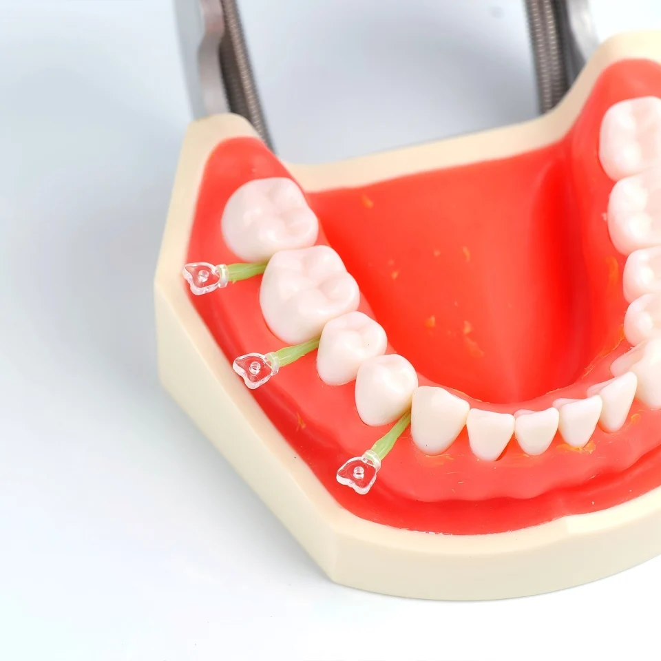 Dental Interproximal Wedges Plastic Coated Soft Resin Coating for Optimal Gingival Seal Matrix System Dentist Tools 50Pcs/Box
