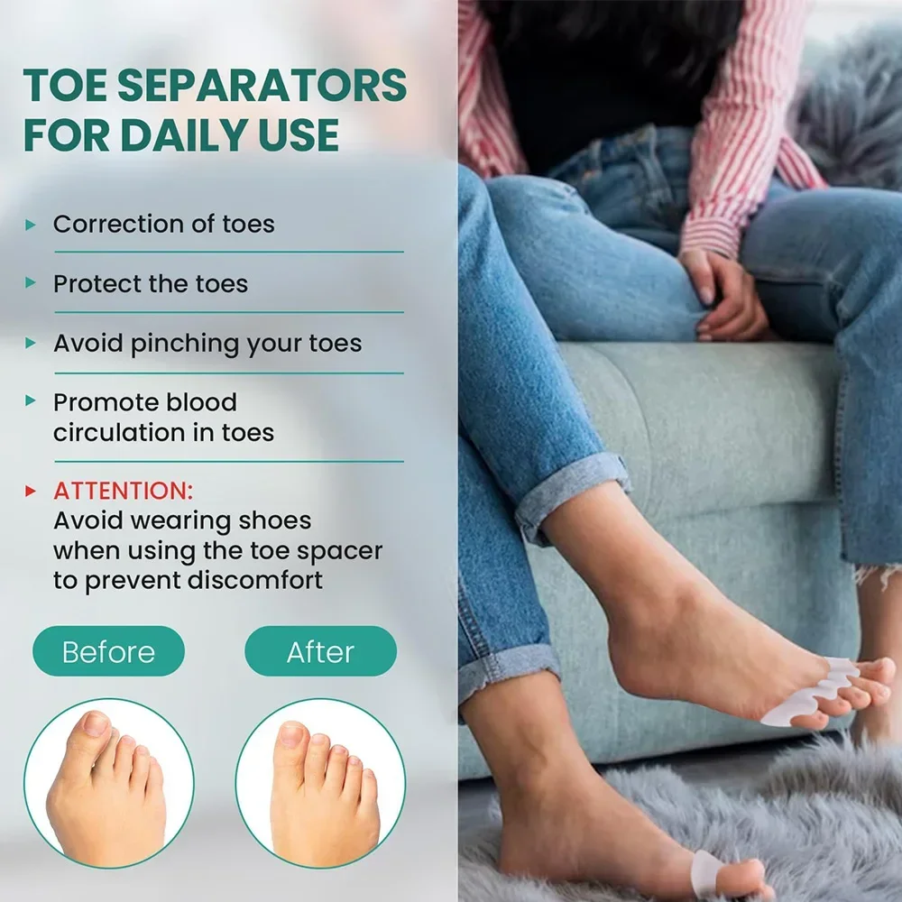 1Pair Silicone Finger Toe Protector for Bunion Corrector Material Soft Gel Straightener Spacers Stretchers Care Tool 5 Colors