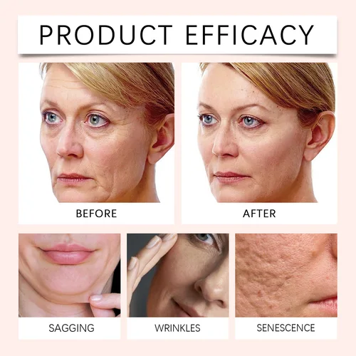 Imagen 2 del producto Hoygi Centella Asiatica Mascarilla de arcilla en barra Calmante Desintoxicante Hidratante Anti irritación Fácil aplicación Todo tipo de piel