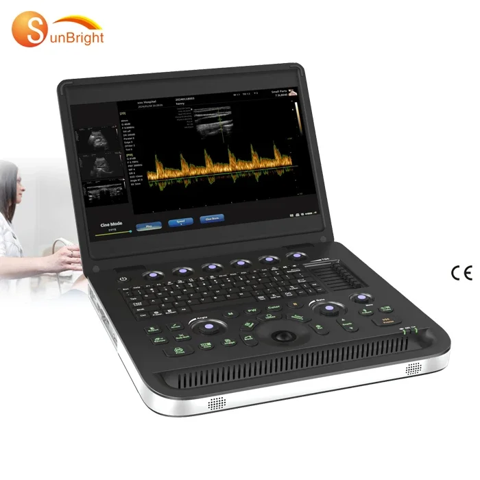 Medical digital doppler Ultrasound Instrument 2D Doppler Ultrasound Human Use machine