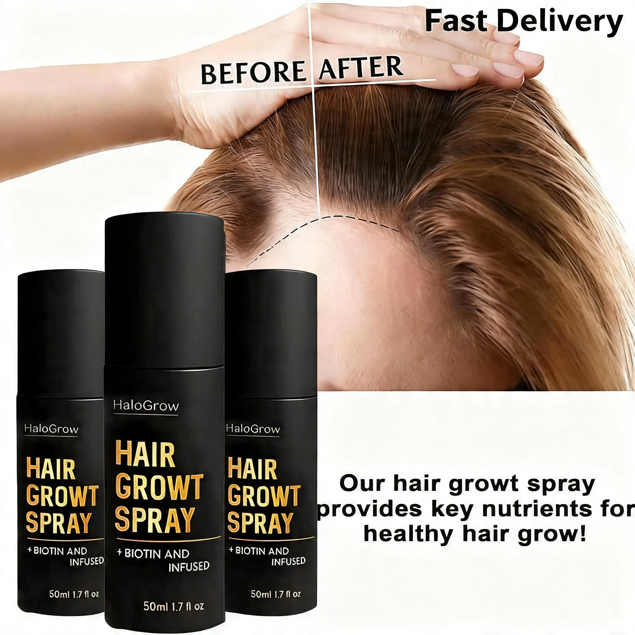 1/2/3 UNIDADES 50ML Spray Capilar com Biotina e Cafeína para Crescimento Avançado do Cabelo, Cuidado Intenso, Reduz a Queda de Cabelo, Spray Capilar Original de Gengibre