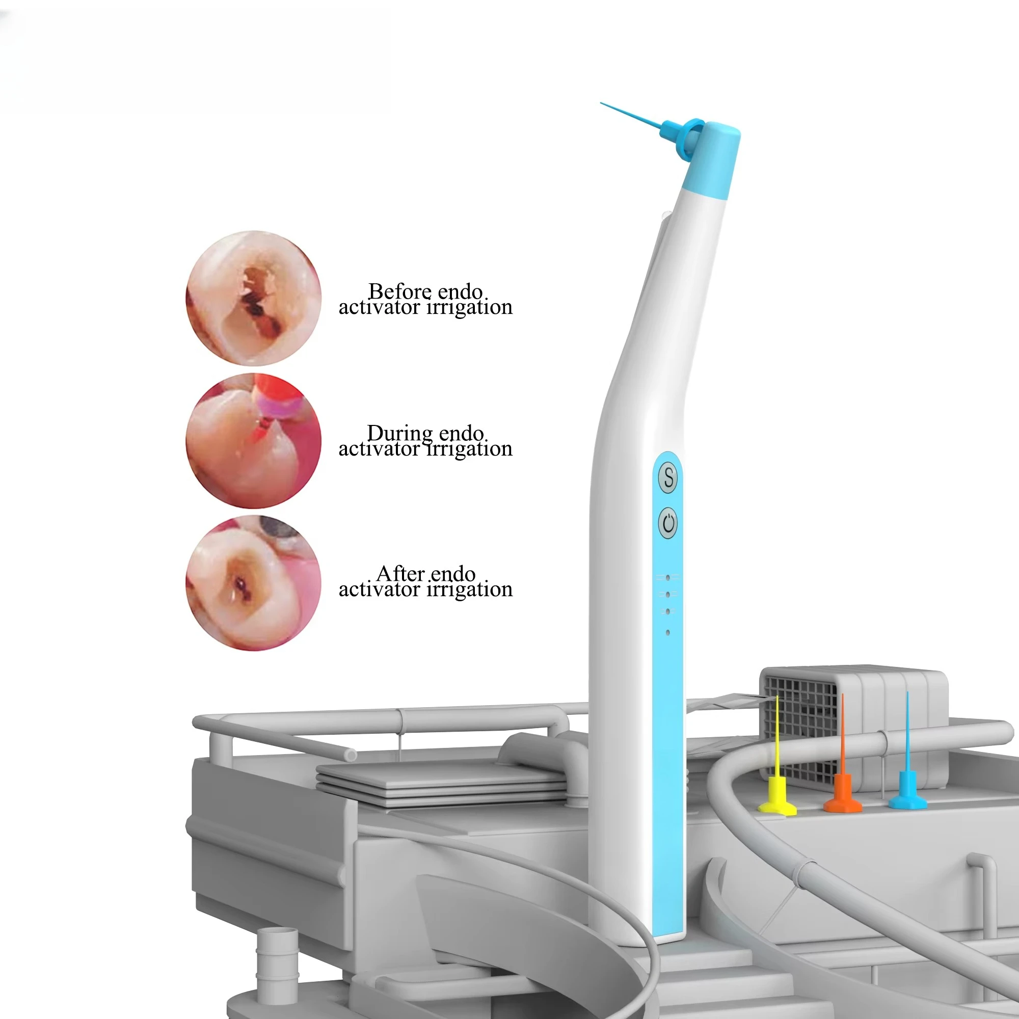 Endo Ultra Activator Sonic Endo Irrigator Root Canal Irrigator With LED Light Dental Sonic Endo Activator With 60 Tips
