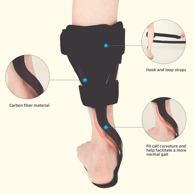 Carbon Fiber Dynamic Foot Drop Brace, Rehab Support for Stroke Hemiplegia, Varus Valgus Correction, Ankle Walking Stabilizer