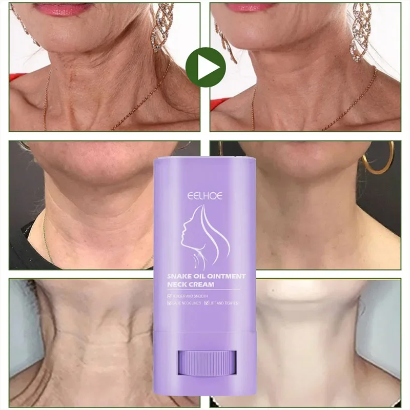 Neck Lines Cream Moisturis Lift Neck Eliminate Double Chin Eliminate Neck Fine Lines Anti-ageing Brightening Moisturizer