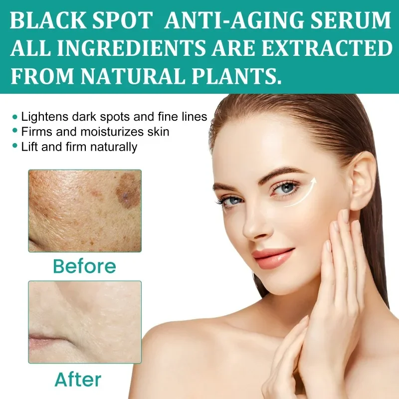 Sdotter New Dark Spot Anti Aging Essence moisturizing skin lighten Melasma Acne Mark remove melanin Freckles anti-wrinkle Facial