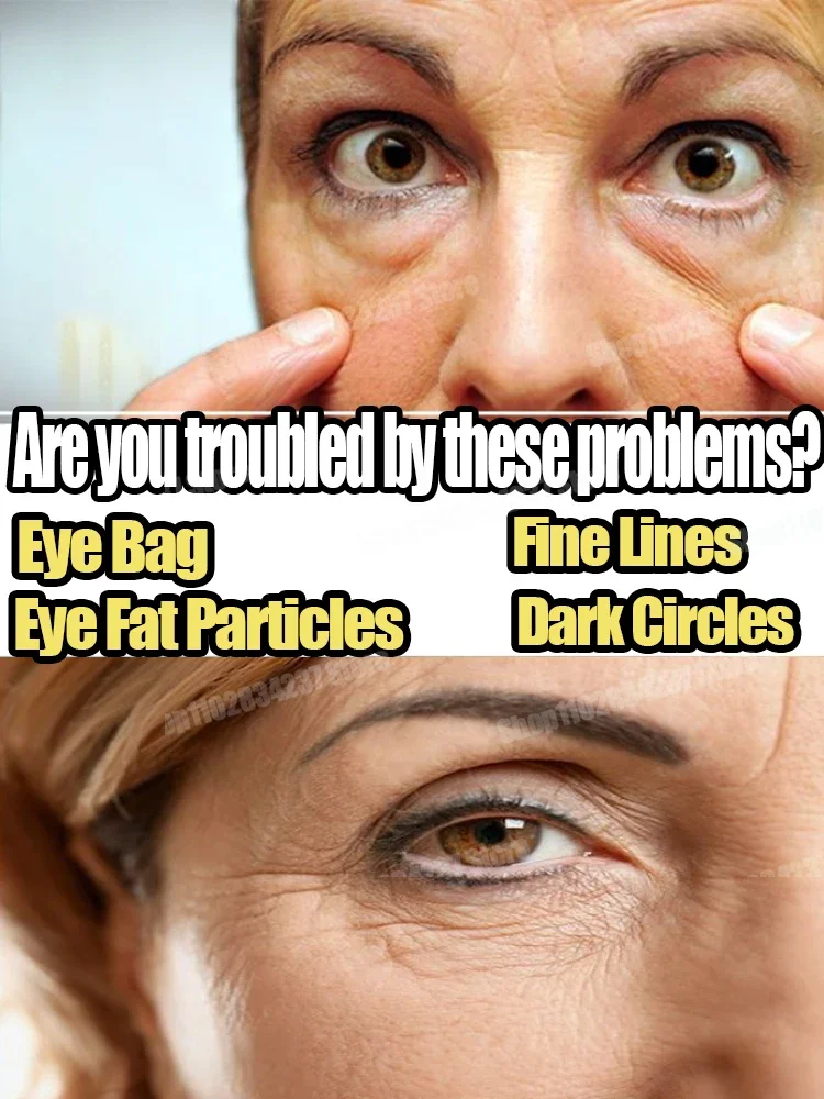 26 アンチエイジング モイスチャライザー アイ クリーム 目の周りを薄め、クマ、目袋、コラーゲンを除去する引き締めアイ クリーム