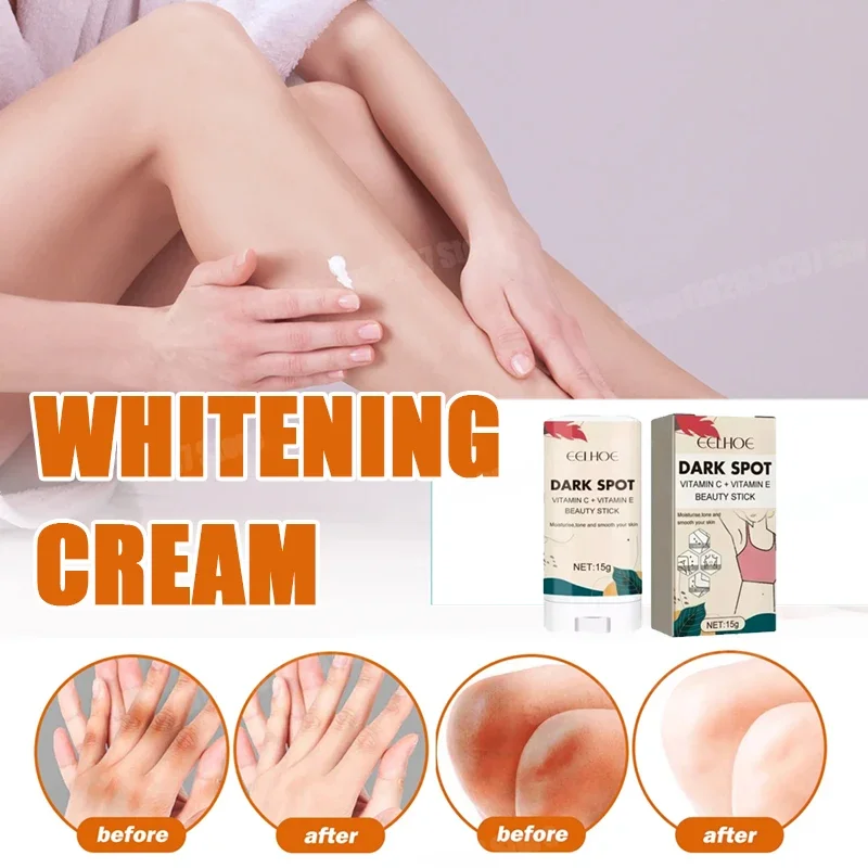 

Dark Knees Elbows Armpit Beaching Serum,Woman Private Part Skin Removal,Dark Knuckles Strong Whitening Serum