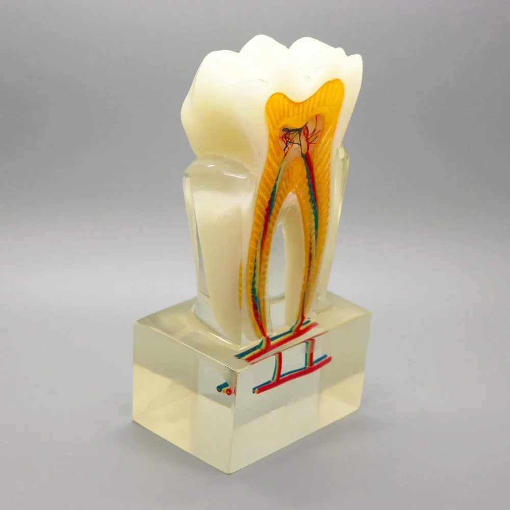 

Orthodontic model 6:1 teeth Teaching with clear base nerve anatomical dissection demonstration Dentis endodontics