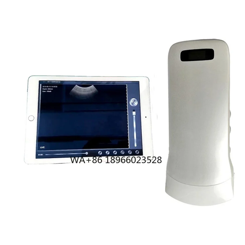 

Supply Cheap Wireless Hand Held Abdomen Ultrasound Scanner Convex Probe Android