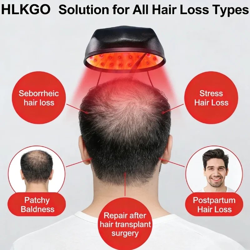 

HLKGO Advanced Laser Hair Regrowth Helmet, Hair Loss Treatment Cap for Men and Women Scalp Care Home Therapy