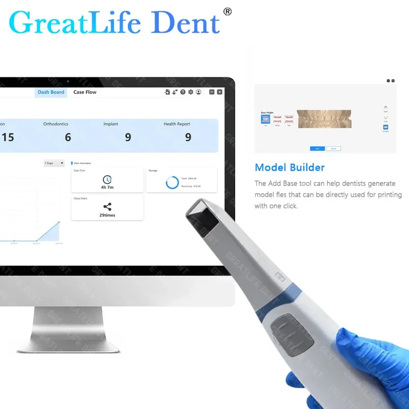 المكسيك الاتحاد الأوروبي الولايات المتحدة الأسهم GreatLife دنت الأسنان Runyes 3.0 Pro الماسح الضوئي ثلاثي الأبعاد داخل الفم مع برنامج مجاني CAD CMD ترميم تقويم الأسنان #3
