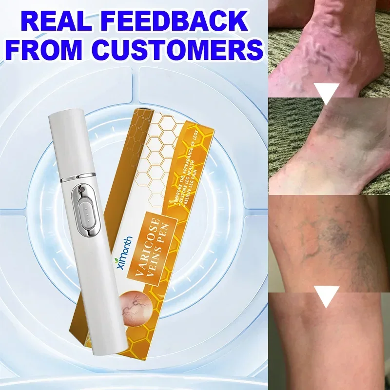 Effective Scar LASER PEN，For all kinds of scars，Burn，Surgical scar，Various scars age