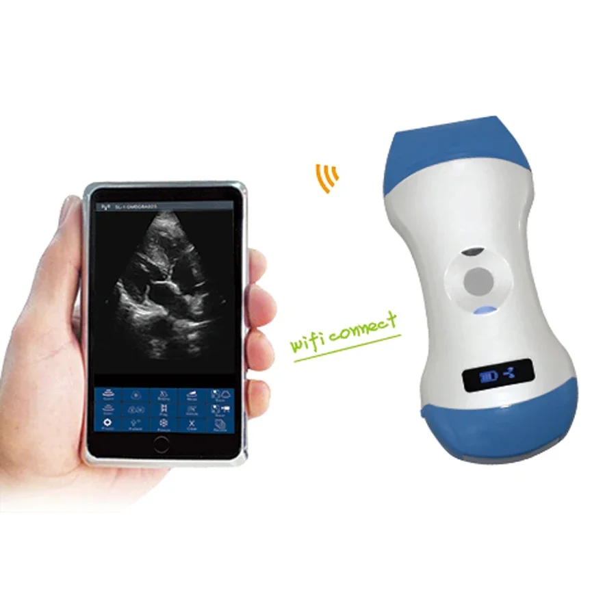 The latest 3-in-1 WiFi wireless ultrasound probe for color Doppler ultrasound for doctors to use