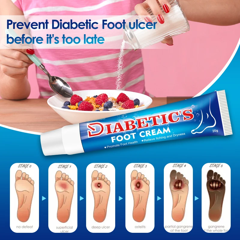 Sumifun Diabetes Ulcer Foot Treatment Cream Anti Inflammation Debaucjed Diabetic Ulceration Itch Relief Skin Repair Ointment 20g