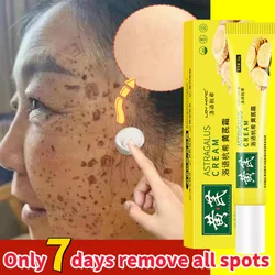 Astragalus Whitening Freckle Cream Effective Brighten Skin Remove Dark Spot Melasma Fade Melanin Acne Scars Anti-aging Skin Care