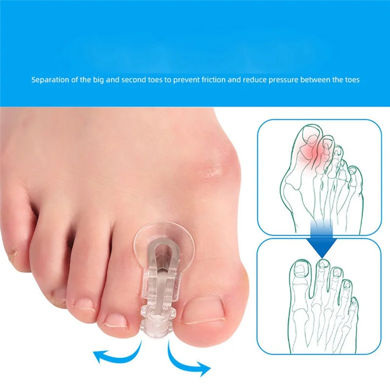 LITE-10er-Pack Zehenabstandshalter, Separatoren, Bunion Corrector Gel Orthesen für Bunion, überlappende Zehen, Hallux Valgus 3,5 x 2 cm