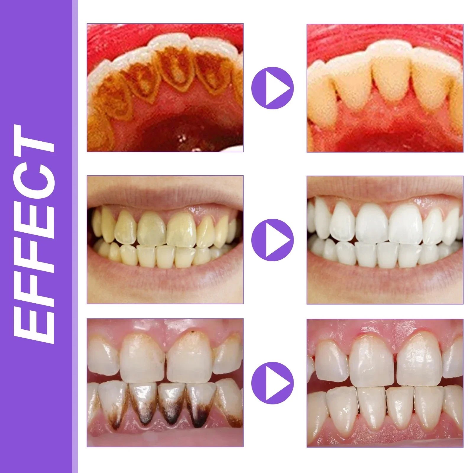 Purple Whitening Toothpaste Clean Stains & Odor Brighten Teeth & Gums Purple Toothpaste Remove Tartar Clean Oral Hygiene