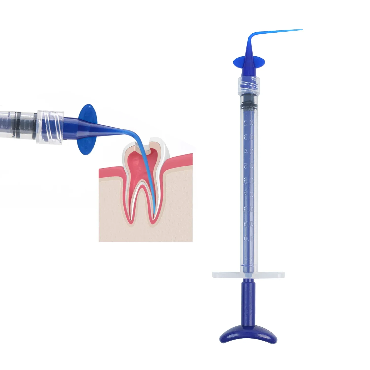 JOLANT-Jeringa de riego Dental de 5 piezas, jeringa desechable de 1ML de plástico azul, herramientas dentales para blanqueamiento Dental